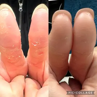 ネイル 橋口 むつみのネイルデザイン