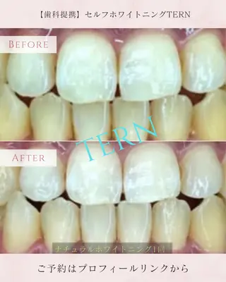 小顔・ニキビ・肌管理 TERN 南草津店のエステ・リラクイメージ