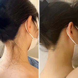 うなじ脱毛/美肌脱毛 LABELのエステ・リラクイメージ