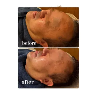 Esthesalon MOONのその他イメージ