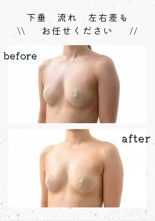 全身整えるバスト ケア【cany】のエステ・リラクイメージ