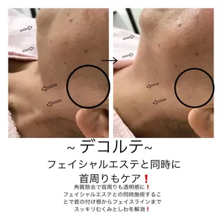 ビューティー ミロワールのエステ・リラクイメージ