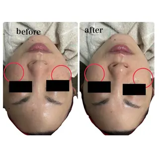 𝐑𝐢𝐞𝐯𝐞所属・HIROTA 𝐑𝐀𝐍のエステ・リラクイメージ