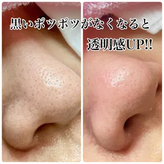 フェイシャルエステFOUATONS*所属・フェイシャルエステ ふわっとんのエステ・リラクイメージ