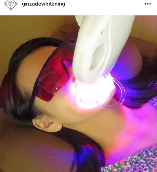 銀座deホワイトニング所属・銀座de ホワイトニングのその他イメージ