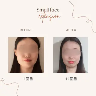 肩こり・腰痛改善専門 1万人以上施術の碧人のエステ・リラクイメージ