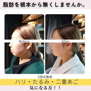 Cheerful所属・痩身＆身体改善専門 Cheerfulのエステ・リラクイメージ