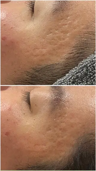 アルカンジュ~archange~所属・痩身/毛穴洗浄/脱毛 アルカンジュのエステ・リラクイメージ