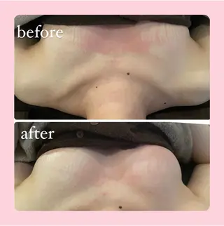 Monreve所属・美人スイッチdiet スーパージェクションのその他イメージ