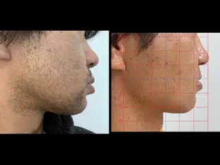 メンズ トータルビューティー サロンCherie2のエステ・リラクイメージ