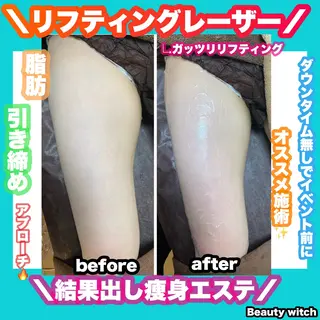 痩身/脱毛/ネイル HARUKAのエステ・リラクイメージ