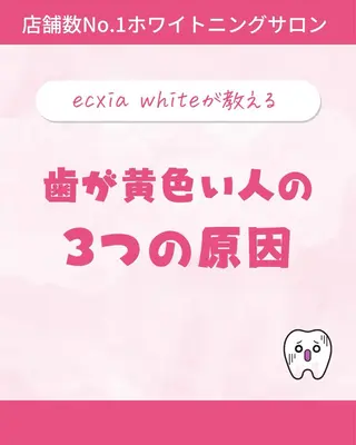 セルフホワイトニング エクシア大曽根店のその他イメージ