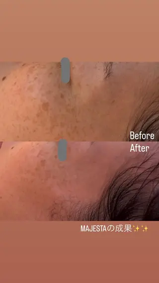 デアイム東広島所属・中井 小春のエステ・リラクイメージ