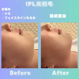 効果重視脱毛サロンRICE所属・肌質改善/都度脱毛 Mahinaのエステ・リラクイメージ