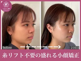 盛れる小顔矯正師 たく先生のエステ・リラクイメージ