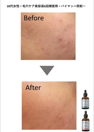 QANAEL所属・QANAEL 小山のエステ・リラクイメージ