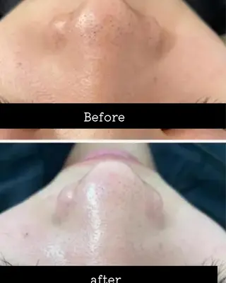 É LINDA所属・E LINDAのネイルデザイン