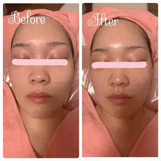 透明感の肌Lino malieのエステ・リラクイメージ