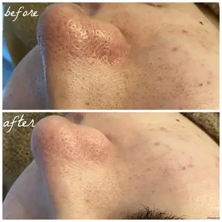 メンズ メナード岐阜市茜部 杉浦のエステ・リラクイメージ