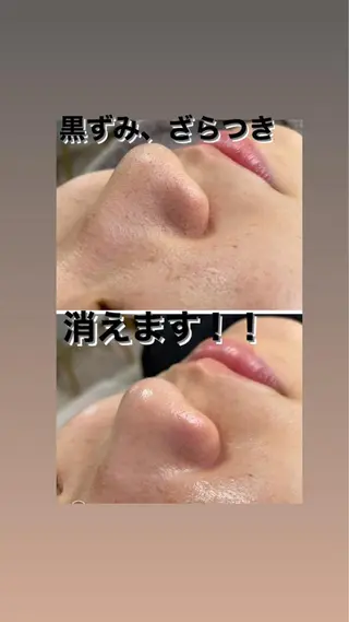 ミディアム カラー パーマ ヘアアレンジ メンズ キッズ ネイル マツエク・マツパ アイブロウ 毛穴，ニキビ跡 改善総合サロンのエステ・リラクイメージ