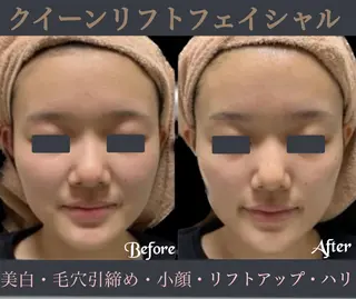 ヴィーナス ビューティーのエステ・リラクイメージ