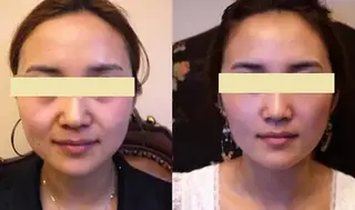 全身脱毛&VIO脱毛 紹介率№1♪リナ♪のエステ・リラクイメージ