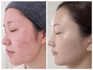 上尾Luce. あきやまのエステ・リラクイメージ