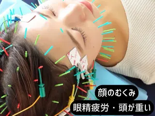 小顔美容鍼専門サロン 渋谷YZのエステ・リラクイメージ