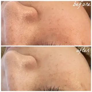 メンズ メナード岐阜市茜部 杉浦のエステ・リラクイメージ