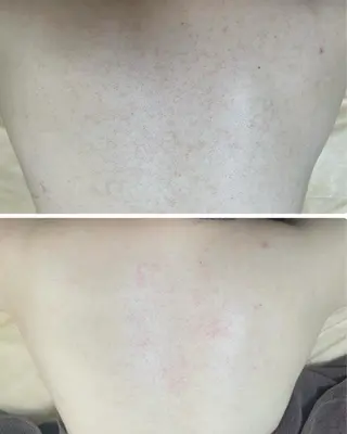 肌質改善サロン La Divinaのエステ・リラクイメージ