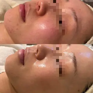 anthes /MIHOのエステ・リラクイメージ