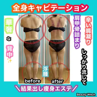 痩身/脱毛/ネイル HARUKAのエステ・リラクイメージ