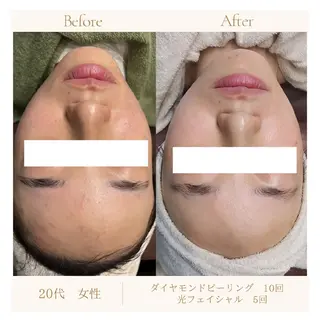 ラヴィエベル 中嶋のエステ・リラクイメージ