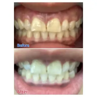 M渋谷店所属・M渋谷 ホワイトニングのエステ・リラクイメージ