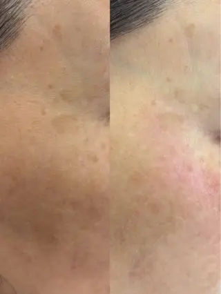 マツエク・マツパ aliaハイフ&水光ジェットサロン所属・aliaハーブ水光店 エステティシャン募集のエステ・リラクイメージ