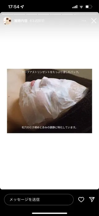 ニキビ跡改善専門🔥 医療にはできない改善のエステ・リラクイメージ