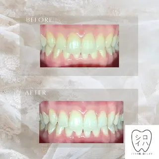 ホワイトニングサロン シロイハ所属・歯を白くしたい方🦷 シロイハのその他イメージ