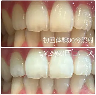 PLATINUM Beauty 横浜店所属・ホワイトニングルーム 横浜店のその他イメージ