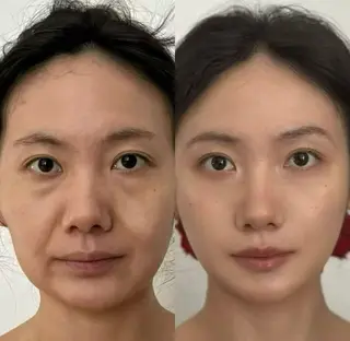 マツエク・マツパ aliaハイフ&水光ジェットサロン所属・aliaハーブ水光店 エステティシャン募集のエステ・リラクイメージ