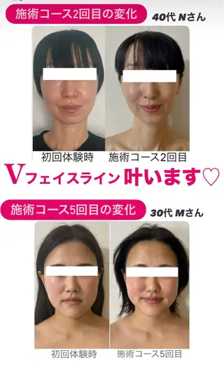 la lumie're (ラ リュミエール)所属・小顔サロン (ラ リュミエール)のエステ・リラクイメージ