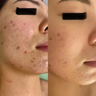 マツエク・マツパ Elysian マツエクサロンのマツエク・マツパデザイン