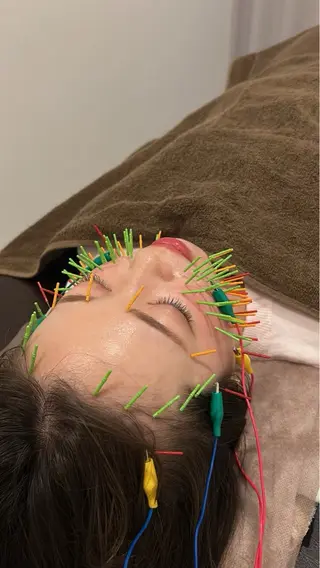 美容鍼灸Solana所属・肌質改善×美容鍼 ゆいのエステ・リラクイメージ