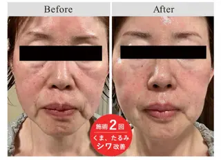 毛穴&ニキビ専門　Bonita Ange恵比寿所属・毛穴ニキビ専門 BonitaAngeのエステ・リラクイメージ