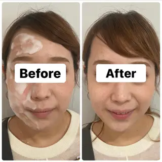 ハーブピーリング専門 muro.のエステ・リラクイメージ