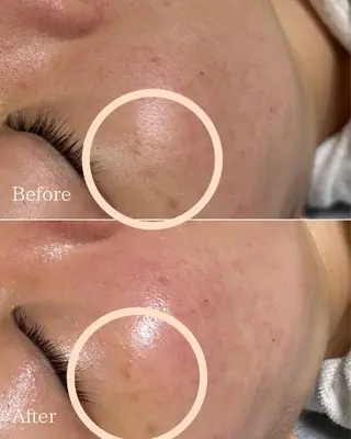 エステと焼き菓子 レモンバームソワンのエステ・リラクイメージ