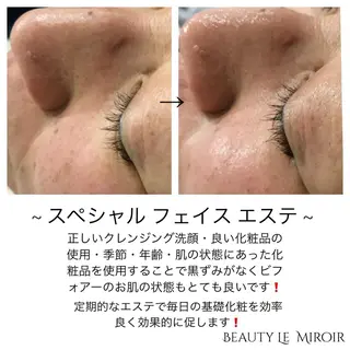 ビューティー ミロワールのエステ・リラクイメージ