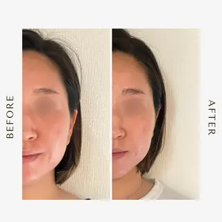 be living 真実のエステ・リラクイメージ