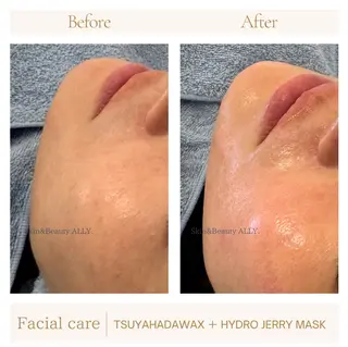 艶肌ワックス ALLY.のエステ・リラクイメージ