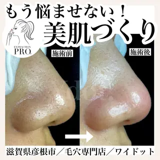 Ydot. 池内 友架のエステ・リラクイメージ