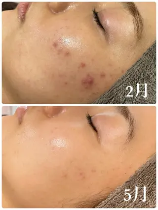 beauty salon LINOBELLE所属・美肌改善専門サロン LINOBELLEのエステ・リラクイメージ